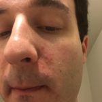 Before - March 2016 - 3