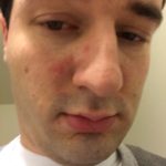 Before - March 2016 - 4